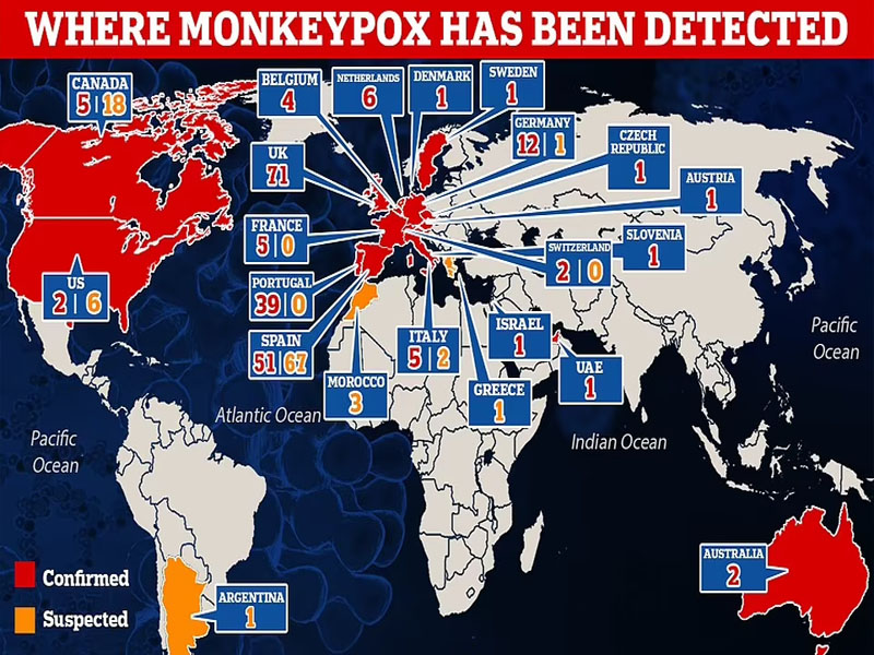 global monkeypox outbreak was waiting to happen scientists say