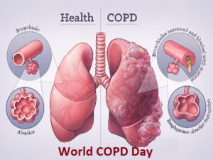 What is COPD