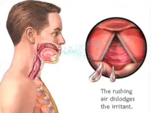 Why Do We Cough