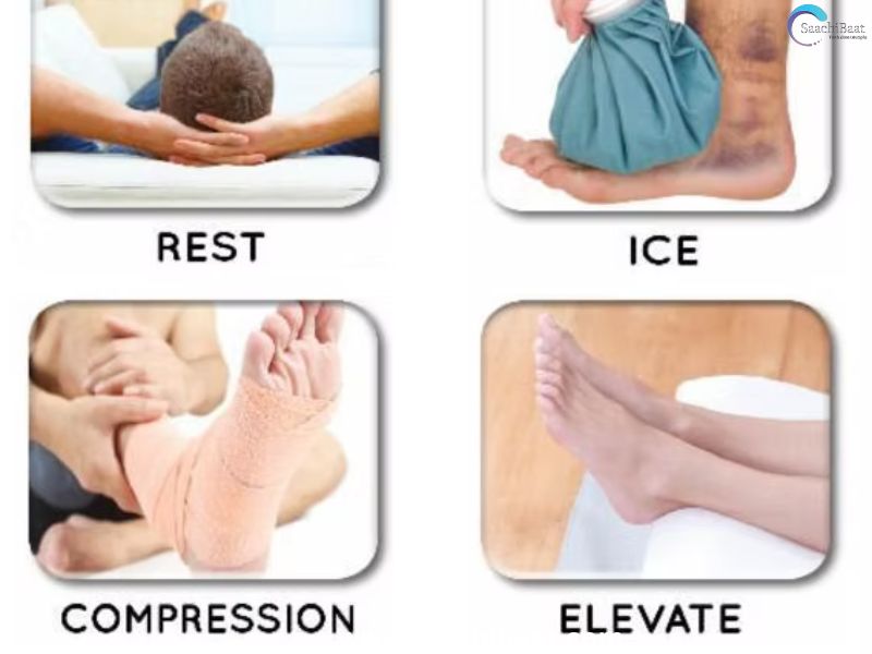 Try RICE for strains and sprains