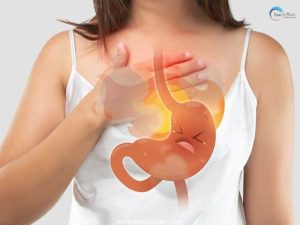 Home remedies for chest burn