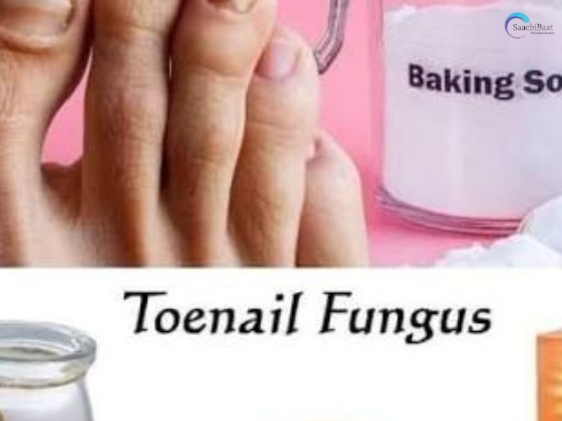 fingernails