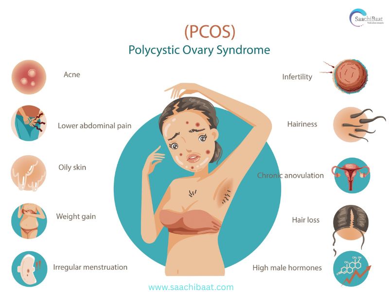 PCOS
