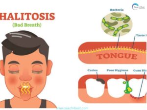 smell from mouth